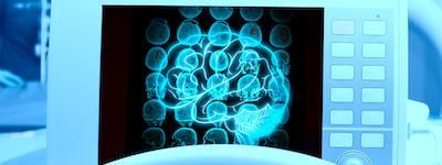 Diagnostico