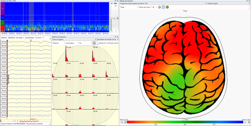 Alzheimer Cartografia