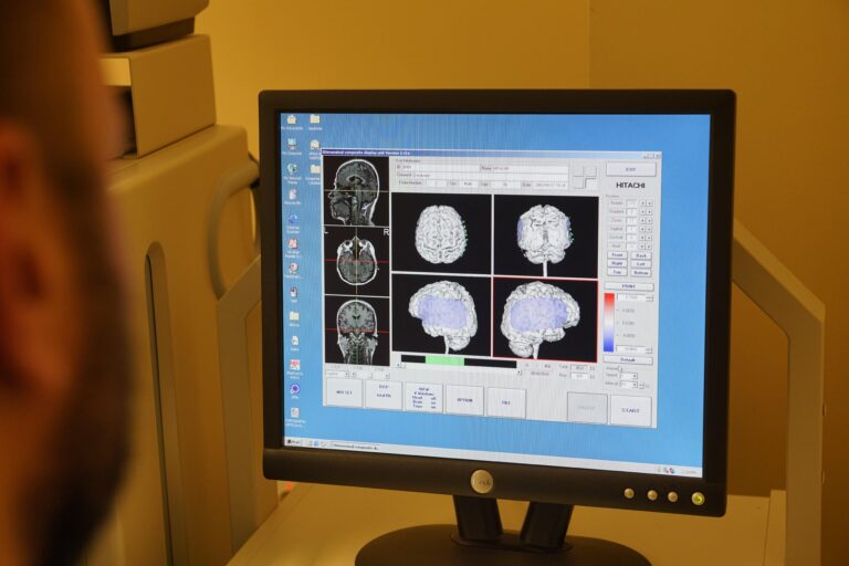 Una persona observa un monitor de computadora que muestra imágenes de un escáner cerebral, incluidas secciones transversales de resonancia magnética y modelos 3D. La pantalla proporciona datos de neuroimagen detallados con varias secciones y áreas codificadas por colores, todo como parte de un proceso de diagnóstico digital avanzado.