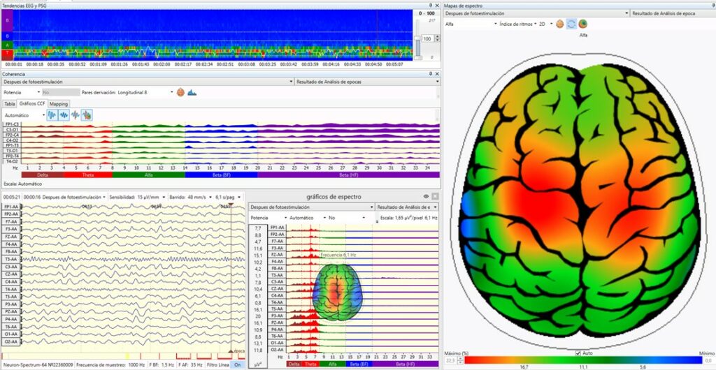Parkinson cartografía