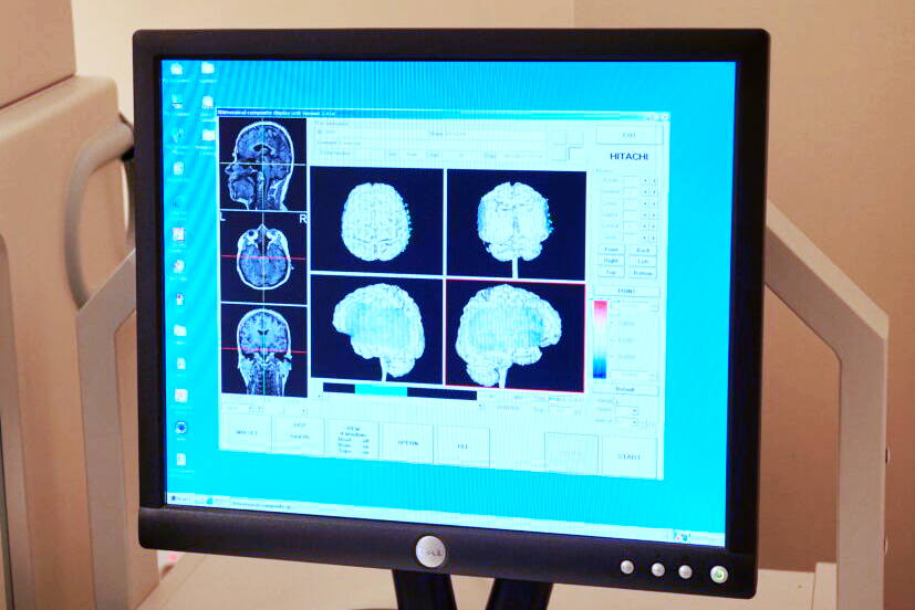 Una pantalla de computadora muestra imágenes cerebrales, probablemente de una resonancia magnética, enfocadas en Prevención y Tratamiento de Parkinson. Se muestran varios ángulos y secciones transversales sobre un fondo azul claro con las imágenes ordenadas en formato de cuadrícula.