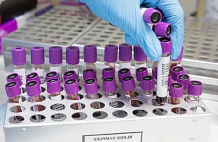 Biomarcadores epigenetica