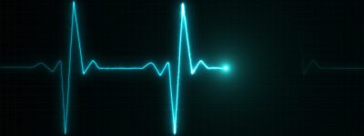 Cardiograma